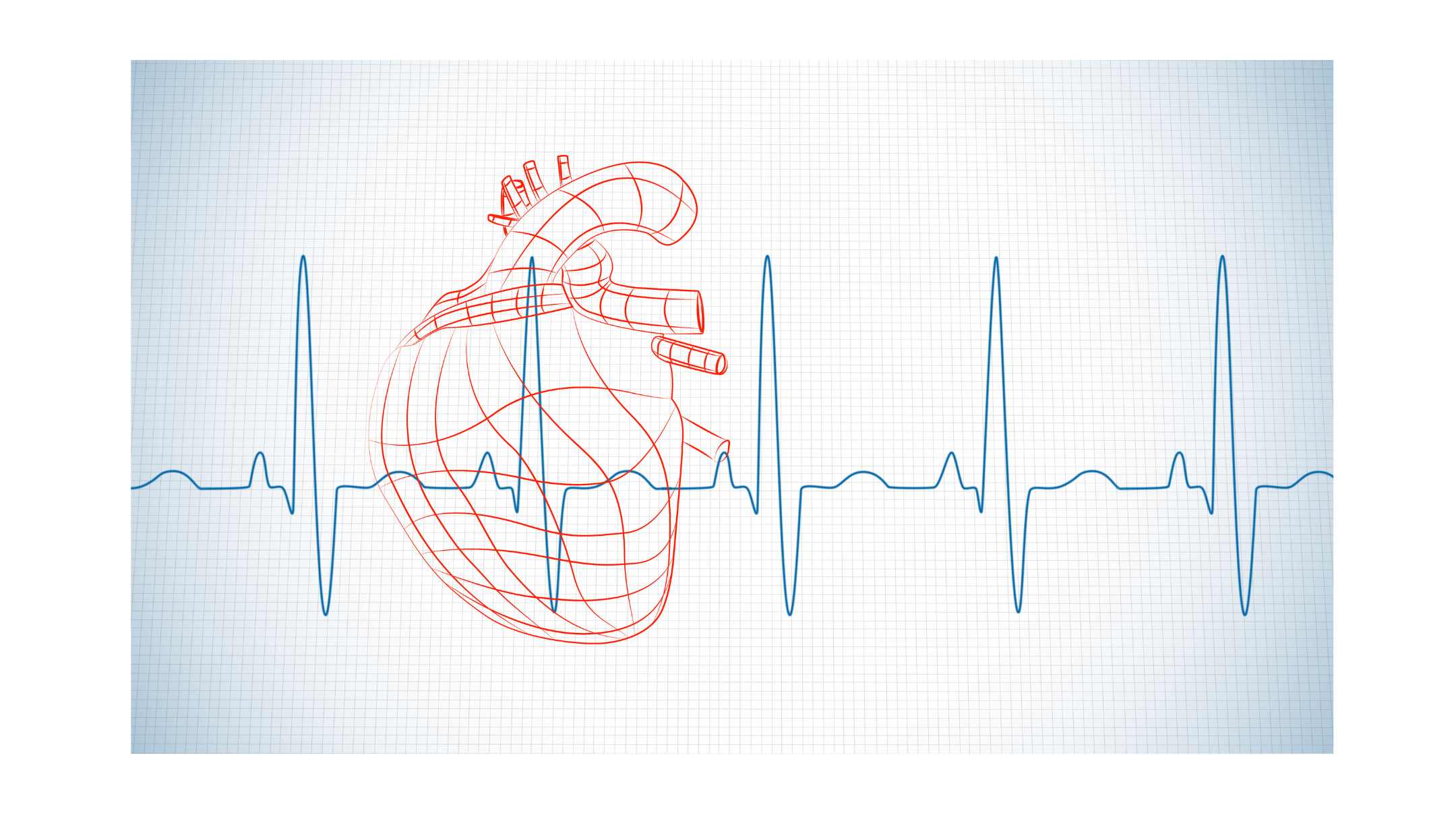 Variabilidad de la frecuencia cardíaca, medición y utilidad